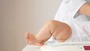 Bebeğin kilo sorunları