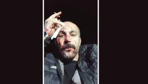 Avukata dipçikle saldırı