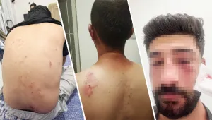 Irkçı linç serbest!