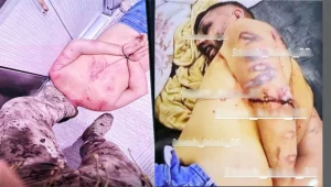 Başsavcılık işkenceyi önemsemedi