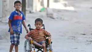 25 bin kişi uzuvlarını kaybetti 4 bin 500 kişi protez bekliyor