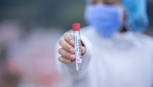 Evde korona testi yapılabilecek