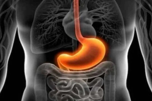 Gastrit