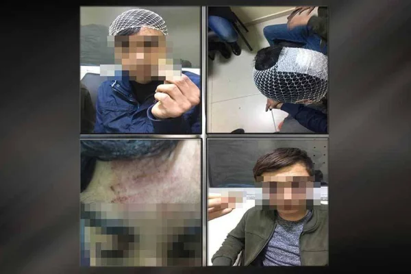 Çocuklara işkenceye takipsizlik