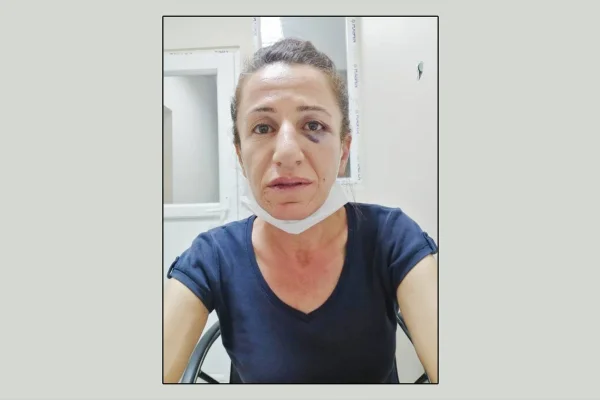 Rojbîn Çetin’e yapılanlarla verilmek istenen mesaj