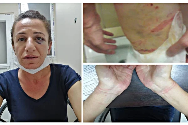 İşkenceden sonra esaret