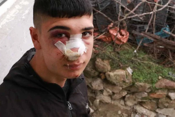 Polis ırkçı saldırganları koruyor