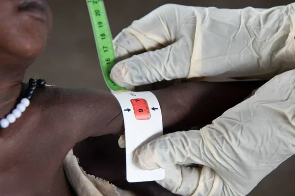 Afrika’da 1,5 milyon çocuk tedavi göremiyor