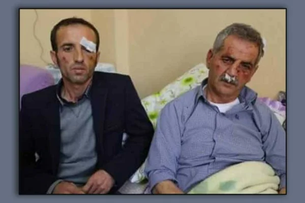 İşkence var, davası yok