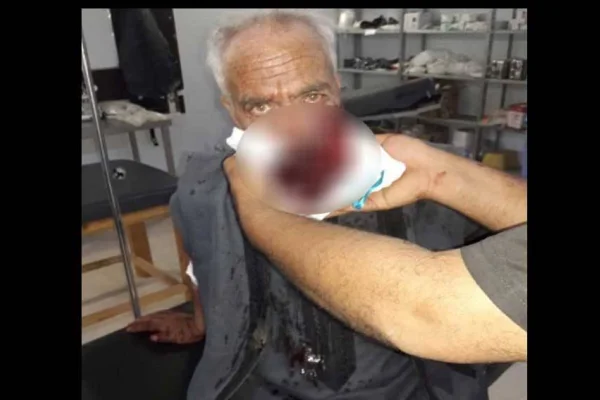 Eyn Îsa ve Girê Spî'de 60 şehit ve yaralı