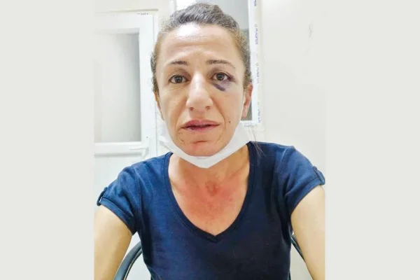 Köpekli işkence 'basit' görüldü
