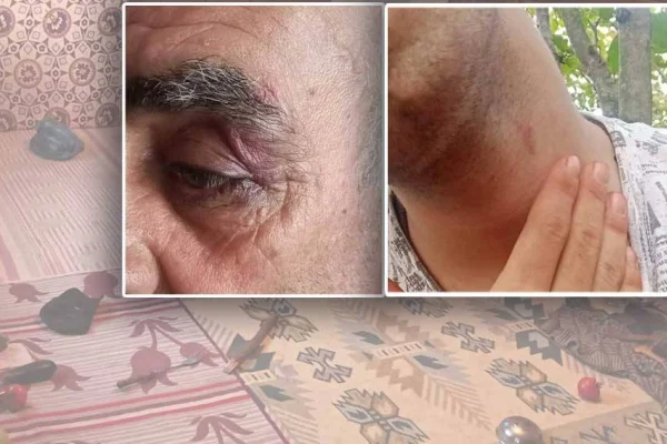 Kürt olunca rahat saldırıyorlar