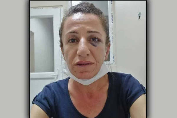 Görevdeki işkenceciye aynı kentte ulaşılamıyor