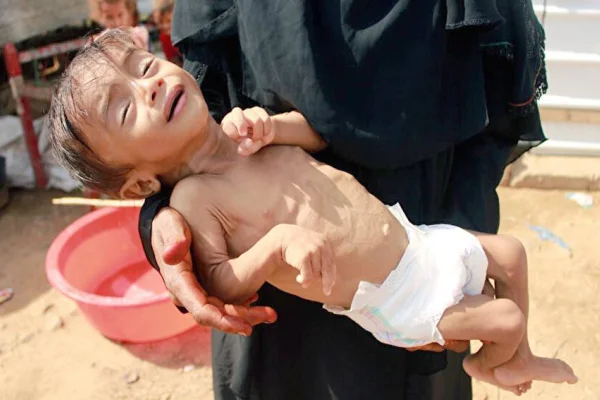 Yemen’de kıtlık yaşanıyor