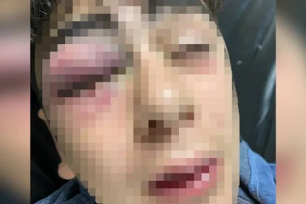 Kamera o an bozukmuş!