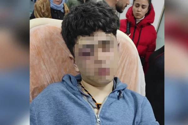 İşkenceye dikkat!