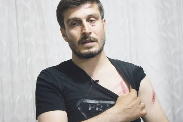 Polis önünü kesip darp etti