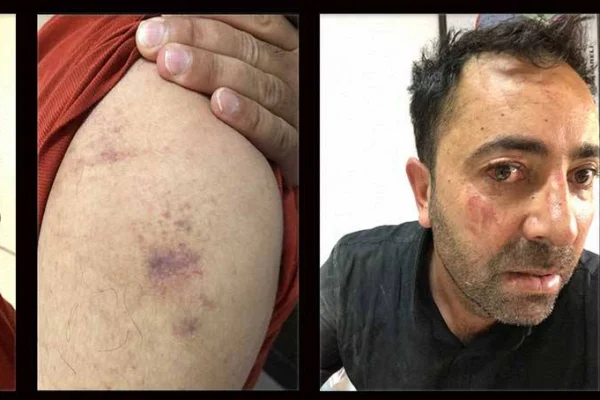 İşkenceli gözaltıdan sonra tutuklama