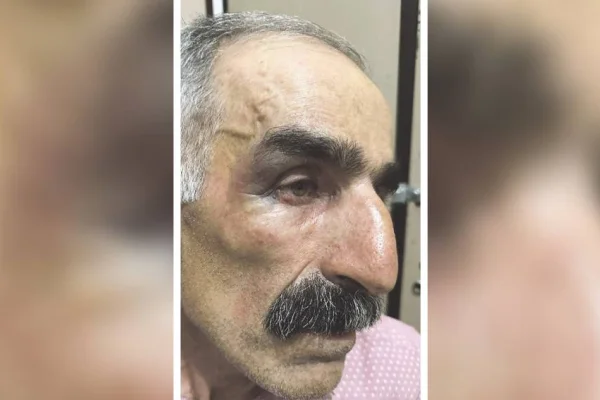 Köylülerle savaşıyor