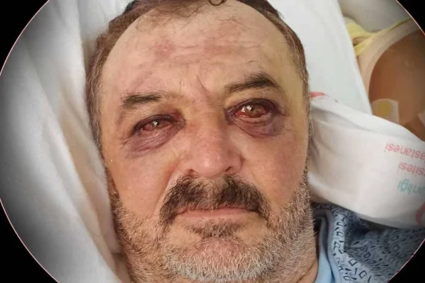 Gözaltından yoğun bakıma suç duyurusu