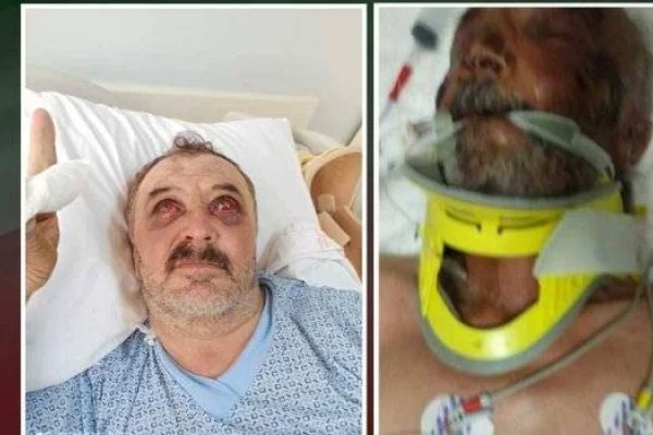 Servet Turgut yaşamını yitirdi