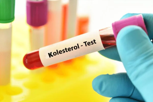 Yüksek kolesterol 