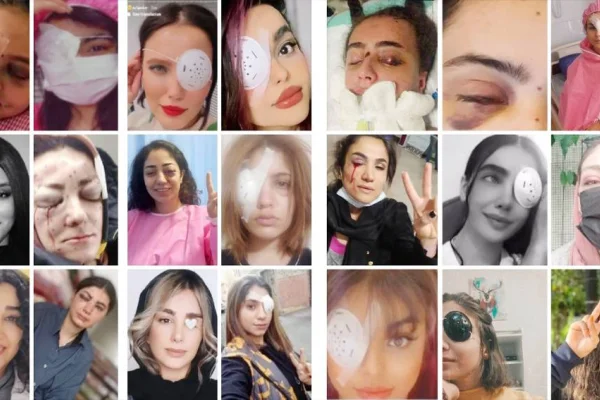 Hem gözüm hem kadınlar için