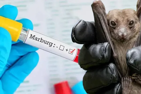 Marburg virüsü hastalığı