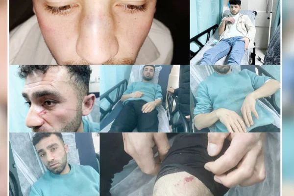 İşkence raporuna gözaltı