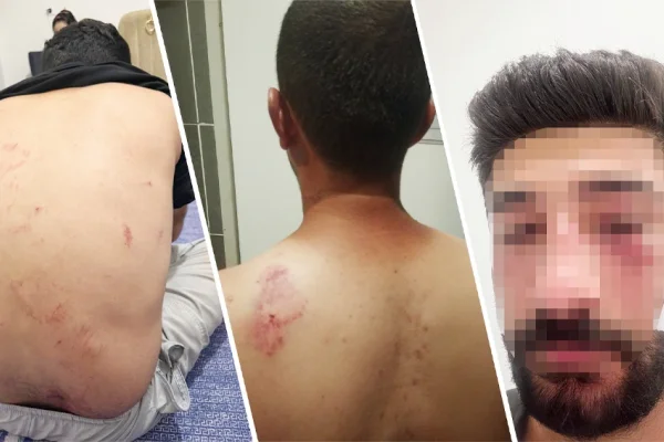 Irkçı linç serbest!