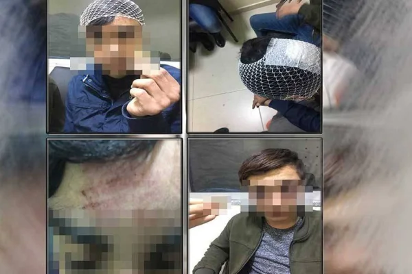 İşkenceden sonra 26 yıl hapis istemi