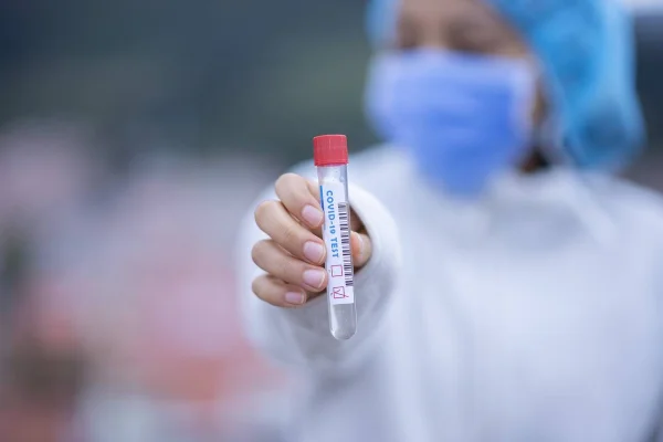 Evde korona testi yapılabilecek