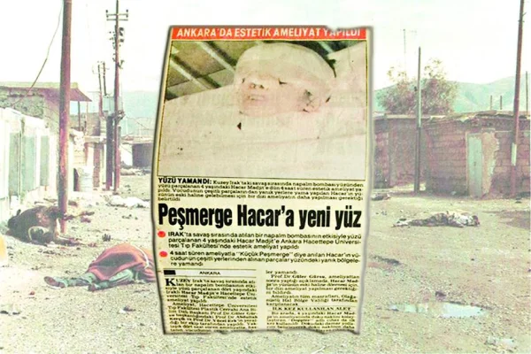 ‘İhrak-ı Binnar’dan kimyasal silaha  Kürt katliam ve soykırımları