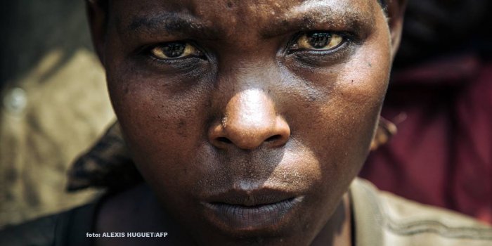 Kongolu kadınlar yardım görevlilerinin cinsel şiddetine uğradı