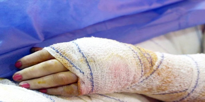 Kendini yakan kadınlar