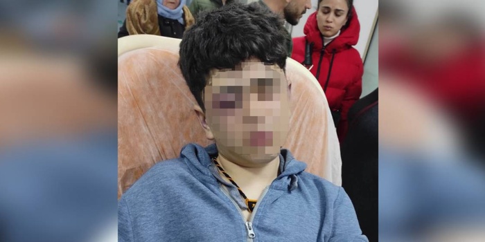 Lice’de polisten işkence gören 14 yaşındaki Y.D.