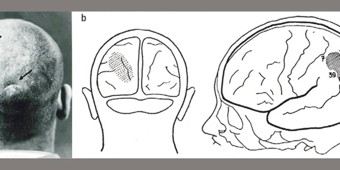 Başından vurulan asker