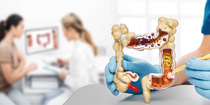 Bağırsak / Foto:AFP