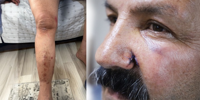 Nevzat Hamzaoğulları işkence